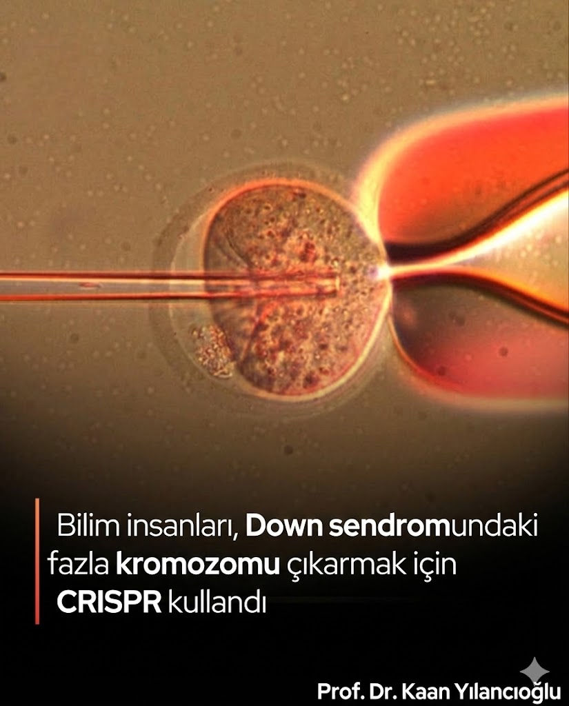 🚨 Tarihte ilk kez CRISPR ile Down sendromuna neden olan FAZLADAN kromozom SİLİNDİ.

Down sendromunun nedeni olan Trizomi 21 (21. kromozomun üçüncü kopyası), insan hücrelerinde CRISPR-Cas9 ile başarıyla ortadan kaldırıldı.

Bilim insanları:
• Kök hücrelerde ve deri hücrelerinde
