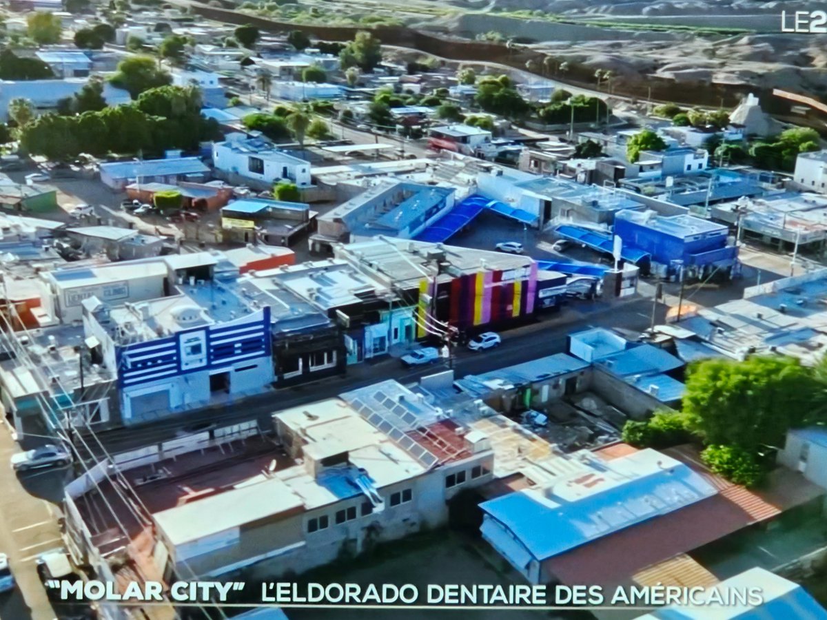 MathieuL1's tweet image. Témoignage larmoyant de TF1 sur les pauvres Américains qui, en l'absence de l'Assurance Maladie®, ne peuvent pas se payer de nouvelles dents. 😢

Alors qu'en France, grâce à notre modèle social irréprochable, on peut se faire faire un implant pour seulement 2000€* (*non couvert…
