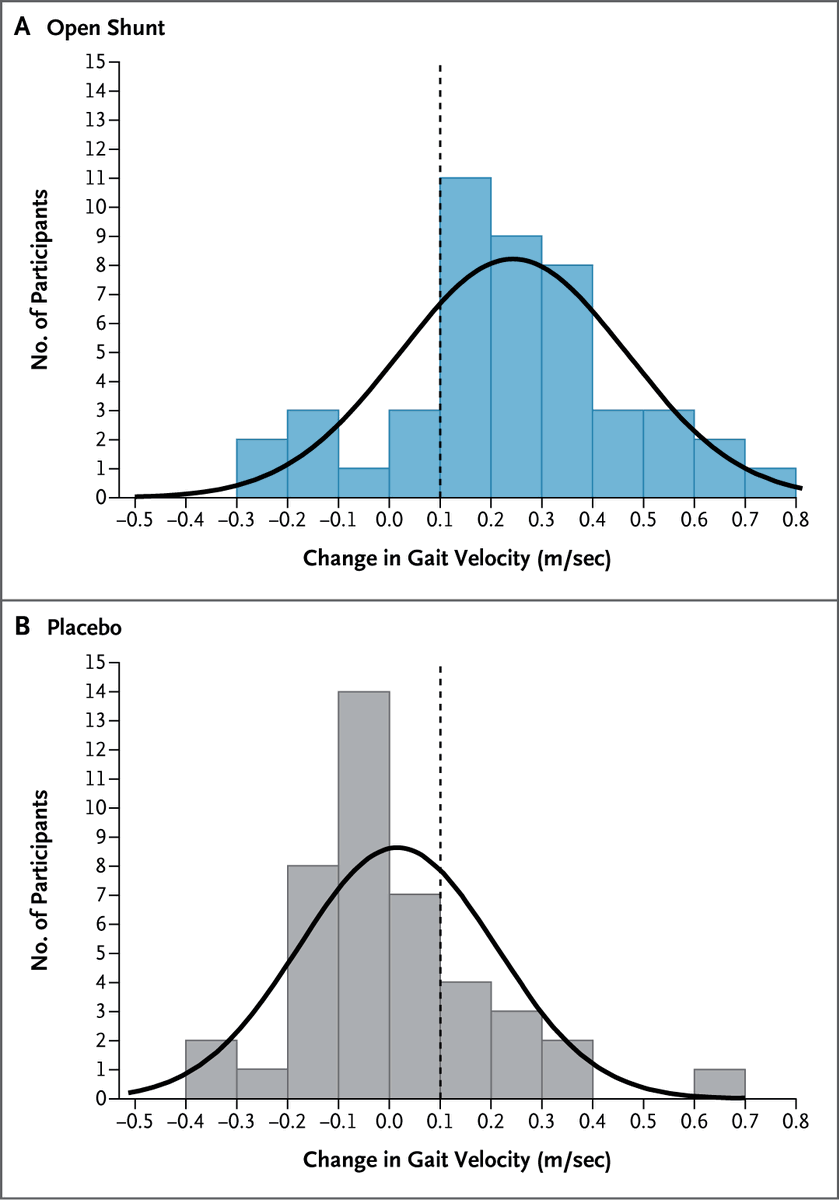 Original Article: A Randomized Trial of Shunting for Idiopathic Normal-Pressure Hydrocephalus (PENS trial) nej.md/41OfPQ5 

Editorial: Small Steps, Big Ventricles: Idiopathic Normal-Pressure Hydrocephalus nej.md/4pmPXF1 

#Neurology