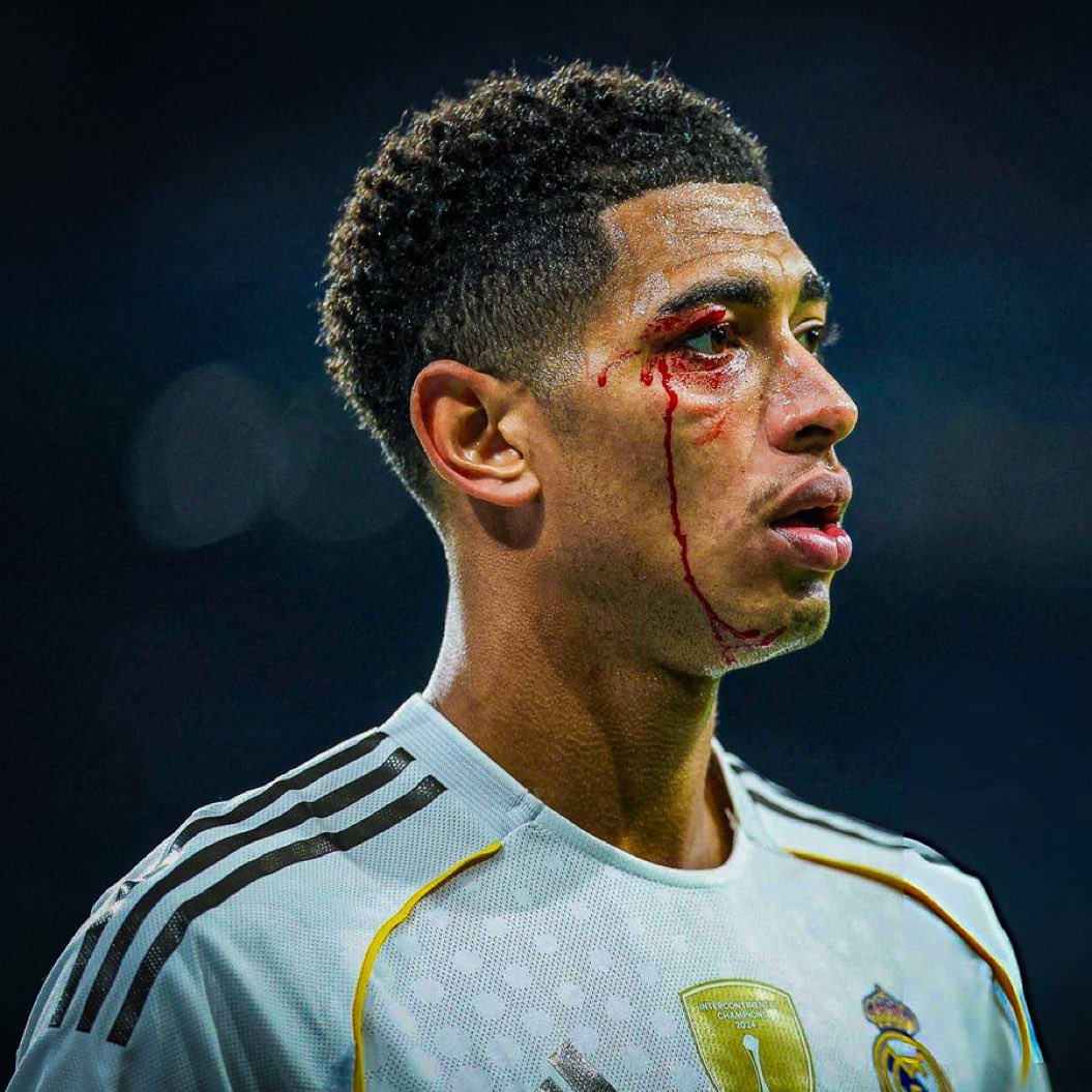 My eyes also bled when I watched Real Madrid play today🩸👀🩸