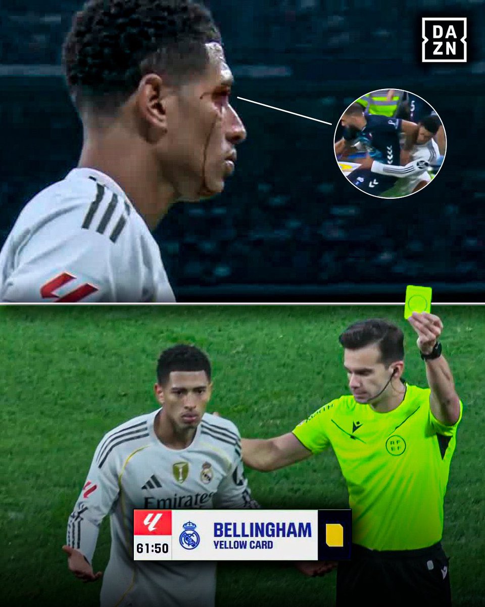 SeputarMadrid's tweet photo. Bellingham kena sikut Iglesias, pelipisnya robek. Lalu ia menepi untuk mendapat perawatan. Setelah selesai, ia kembali masuk ke lapangan, dan... mendapat kartu kuning karena "terlalu cepat masuk lapangan," menurut komentator BeIN.

Gambar oleh @DAZN_ES https://t.co/i7LHkj3kB4