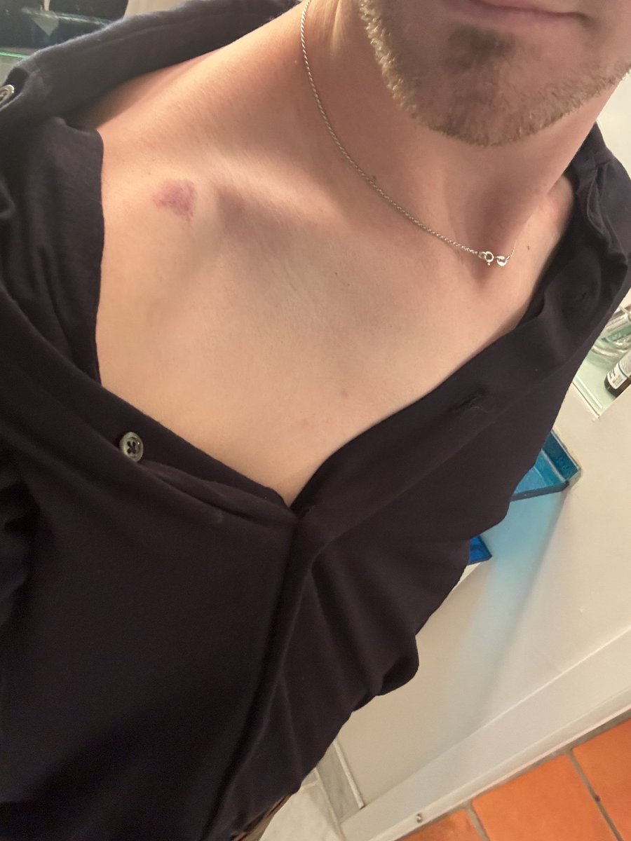 I have been nibbled upon by a man #gayboy