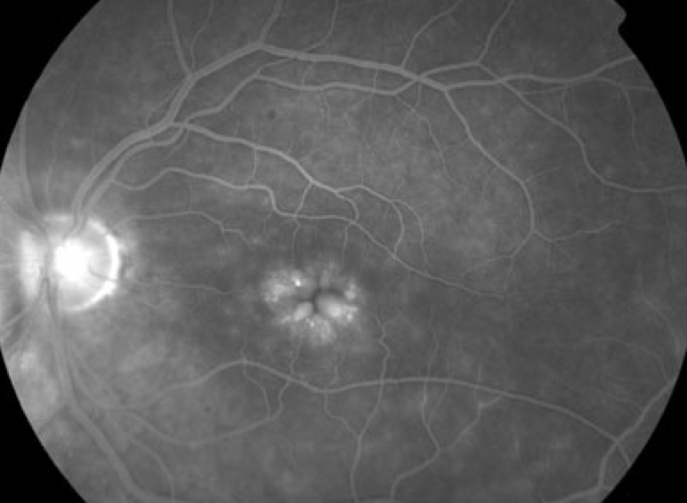 Dr Gunjan Deshpande MRCSEd, FICO (UK), FAICO, DNB tweet media