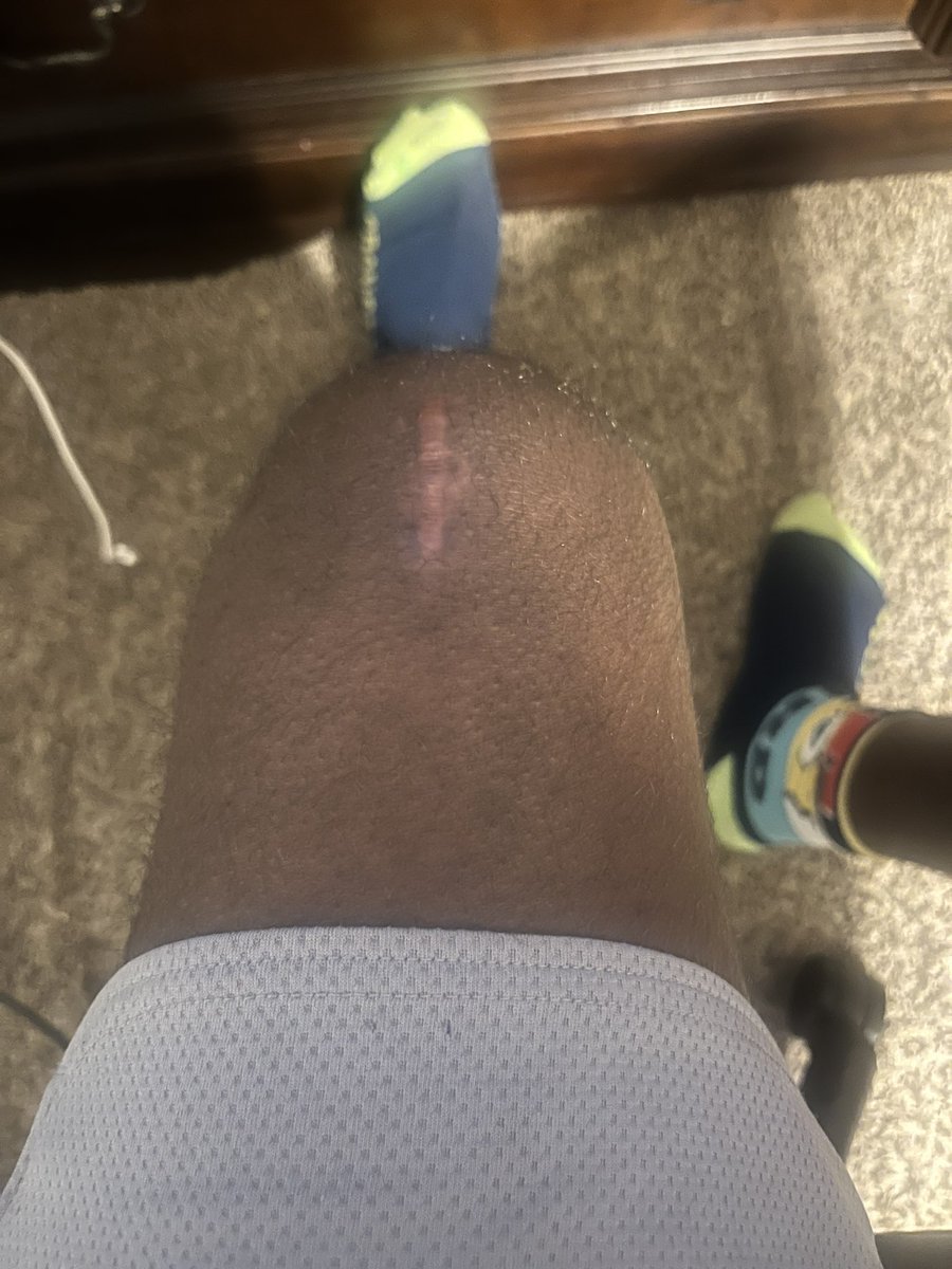 MotionTo5344's tweet image. It been 11 weeks since my acl surgery thank god I hop I have a good recovery as a freshman DE/DT @jeffersoncountyhigh in Fayette ms @Lane_Kiffin, @CoachDancyVI, @coachdt48, @CoachKSwinney, and @CoachJones2010.