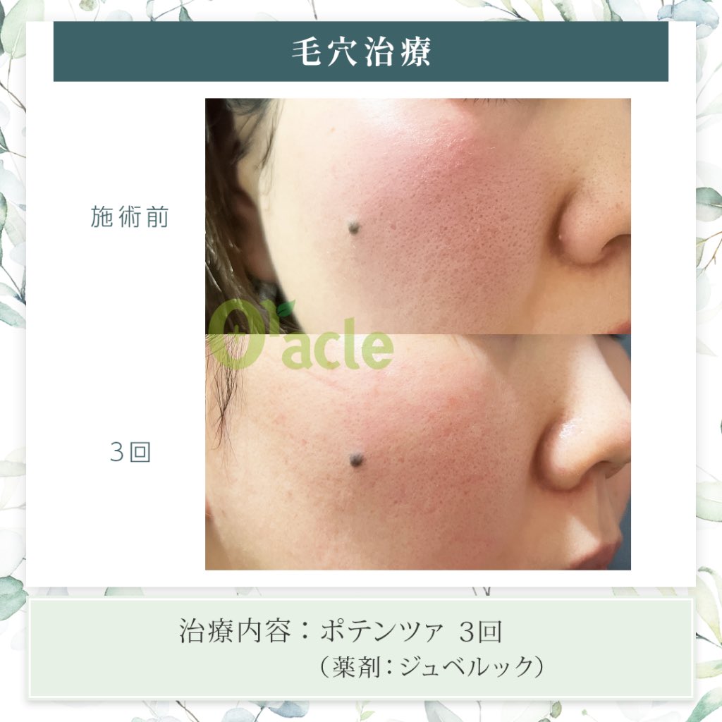 オラクル美容皮膚科【公式】 (@oracleclinic) / Posts / X