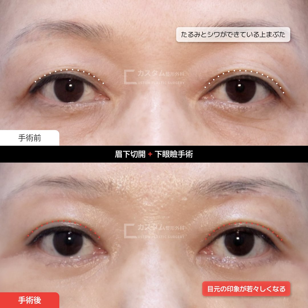 きゅ整形垢 整形垢