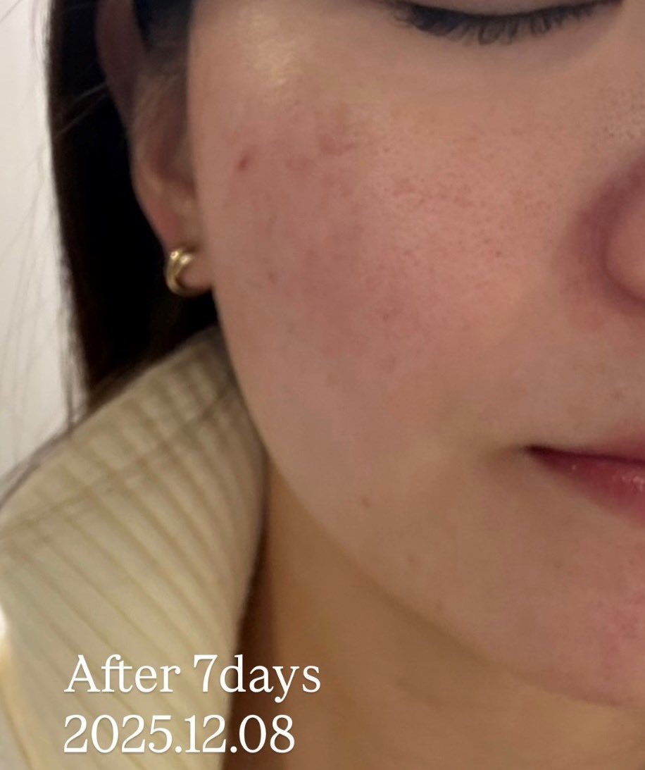 N@韓国美容オタク tweet media