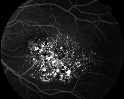 Dr Gunjan Deshpande MRCSEd, FICO (UK), FAICO, DNB tweet media