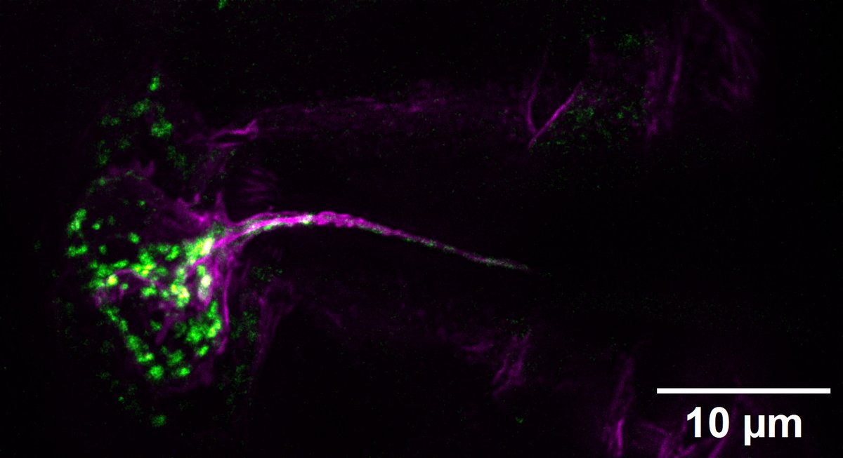 AC_Sayan1996's tweet photo. 3D-STED imaging reveals microtubule-based membrane nanotube that shuttles acidic vesicles in Drosophila egg chambers, an essential 3D nano-highway for fertility. @Abberior @iiserkol @PrasadLabIISERK  
https://t.co/n1AEJEKUpL https://t.co/7p4Ab5V2RD