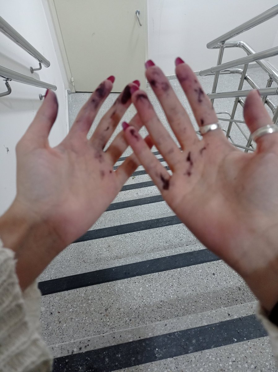 benzerini 2 sene önce yaşadıydım berbat bişi