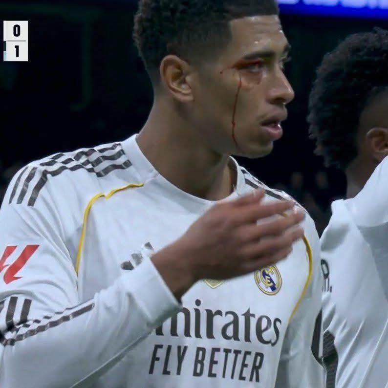 MENINO JEAN🇦🇴 tweet media