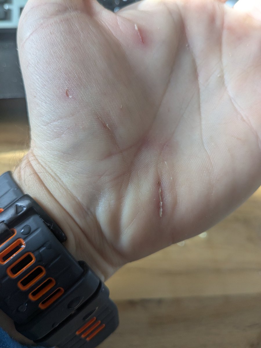 Valentin Sch tweet media