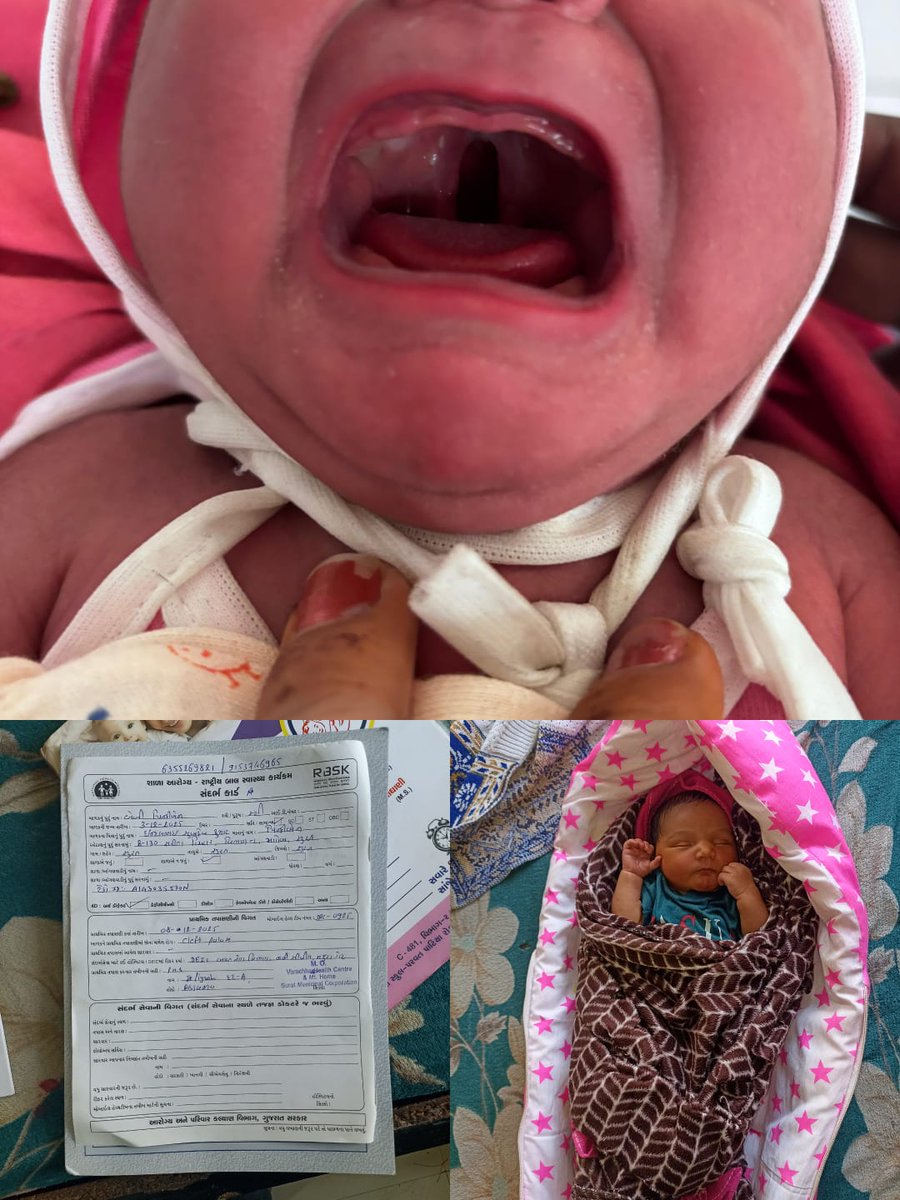 #RastriyaBalSwasthyaKaryakrm 
Home visit of a newborn having Cleft palate baby by RBSK Team, Surat Municipal Corp <a href="/GujaratSHRBSK/">Gujarat SH (RBSK) Rashtriya Bal Swasthya Karyakram</a> @GujHFWDept <a href="/MoHFW_INDIA/">Ministry of Health</a> <a href="/NHMGujarat/">NHM Gujarat</a> <a href="/MoHFW_GUJARAT/">Ministry of Health</a> #GujHFWDept <a href="/MySuratMySMC/">My Surat</a> <a href="/SuratSmartCity/">SuratSmartCity</a>
