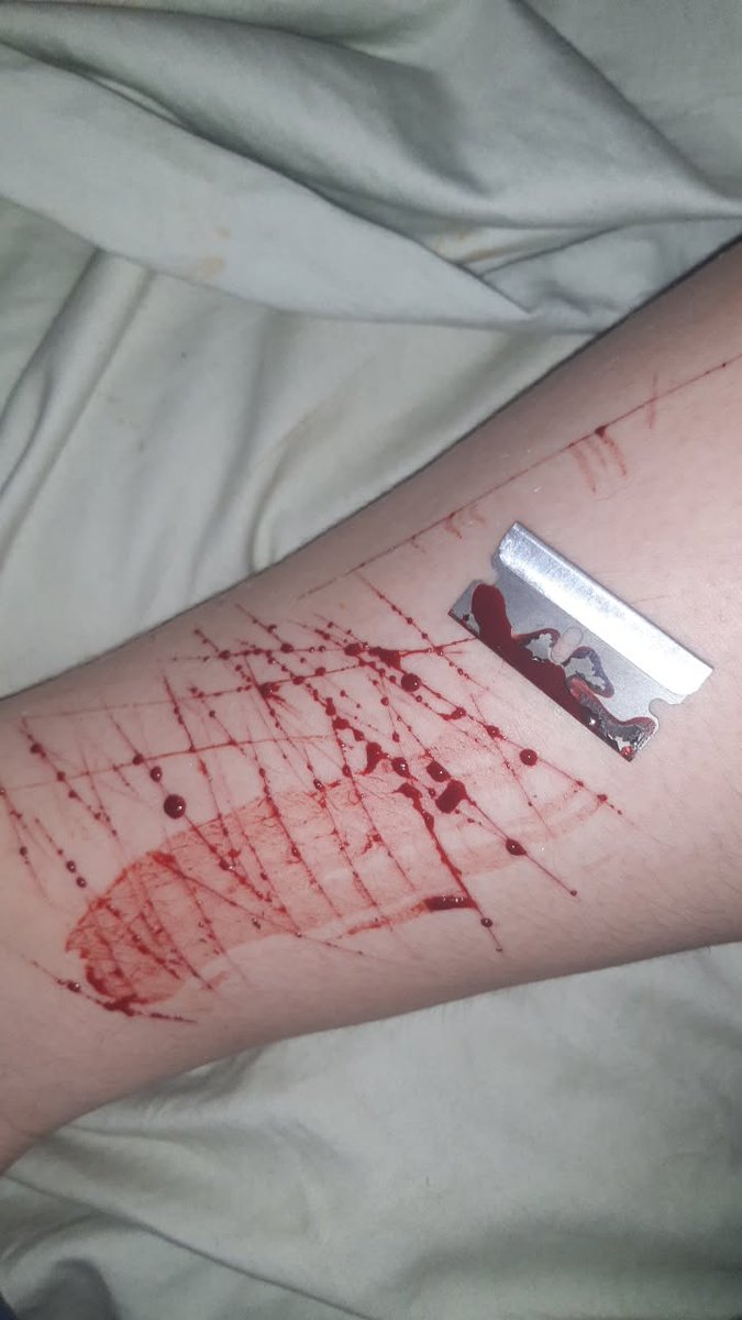 nameless00811's tweet photo. I rlly need to clean the dry blood of my blade lol #shwarning #SELFHARMS https://t.co/KeNGX5lE5v