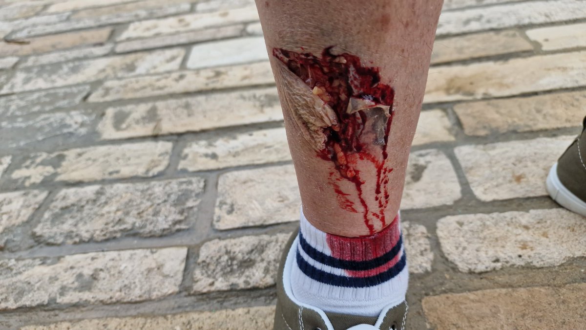 chubby chandler tweet media