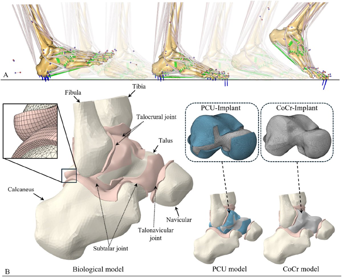 TechAnyBody's tweet image. 🔜 Webcast: 𝐄𝐯𝐚𝐥𝐮𝐚𝐭𝐢𝐨𝐧 𝐨𝐟 𝐚 𝐮𝐧𝐢𝐯𝐞𝐫𝐬𝐚𝐥 𝐭𝐚𝐥𝐮𝐬 𝐢𝐦𝐩𝐥𝐚𝐧𝐭 𝐝𝐮𝐫𝐢𝐧𝐠 𝐠𝐚𝐢𝐭: 𝐚 𝐜𝐨𝐦𝐛𝐢𝐧𝐞𝐝 𝐦𝐮𝐬𝐜𝐮𝐥𝐨𝐬𝐤𝐞𝐥𝐞𝐭𝐚𝐥 𝐚𝐧𝐝 𝐟𝐢𝐧𝐢𝐭𝐞 𝐞𝐥𝐞𝐦𝐞𝐧𝐭 𝐦𝐨𝐝𝐞𝐥𝐥𝐢𝐧𝐠 𝐚𝐩𝐩𝐫𝐨𝐚𝐜𝐡

🔗attendee.gotowebinar.com/register/92066…