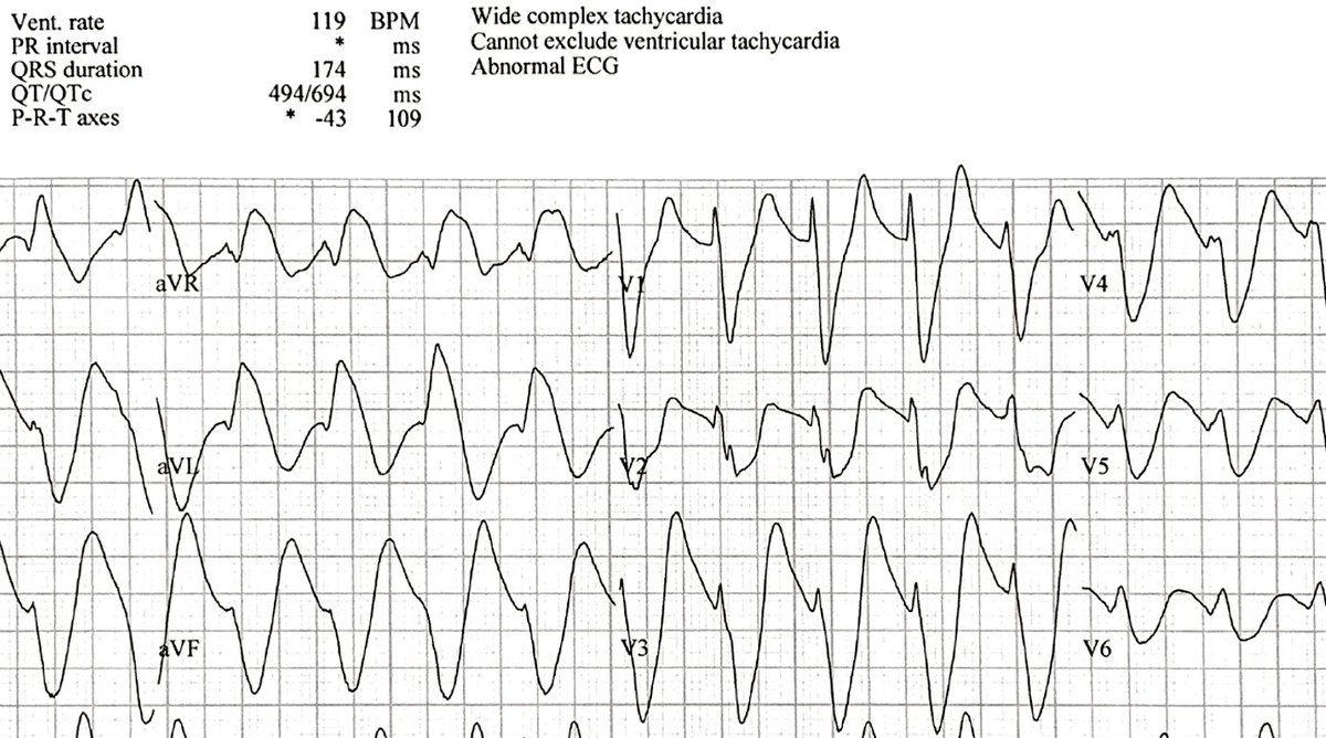 ECGWeekly tweet media