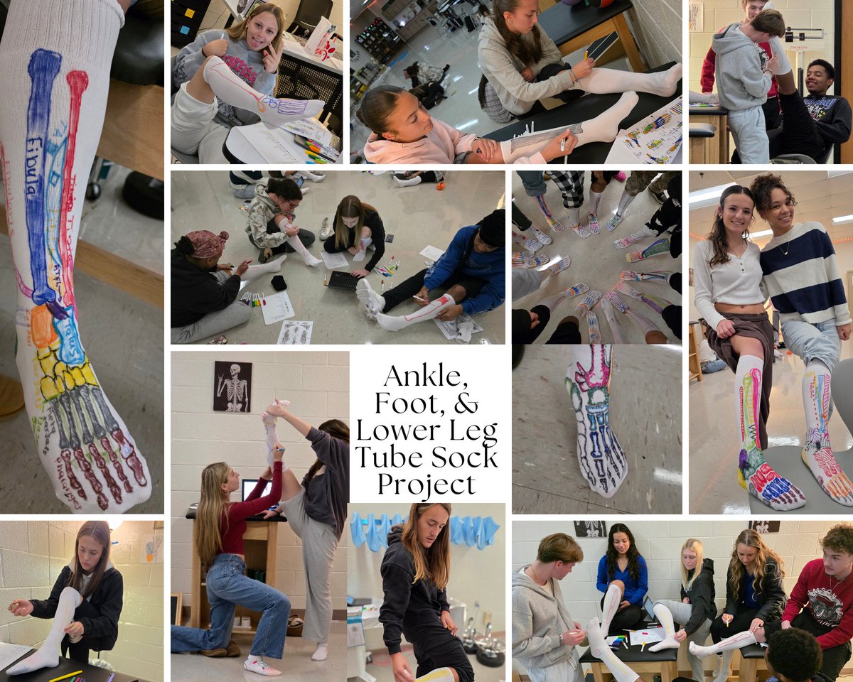 SpotsyCTC's tweet image. 🧦💪 Our Sports &amp;amp; Health Science students got creative! They illustrated the bones and muscles of the ankle, foot, and lower leg on tube socks as part of their anatomy project. Love the hands-on learning! 👏✨
#SpotsyCTC #CTE #HandsOnLearning