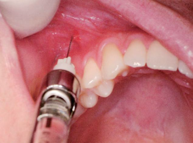 EndoLopezCepero tweet media