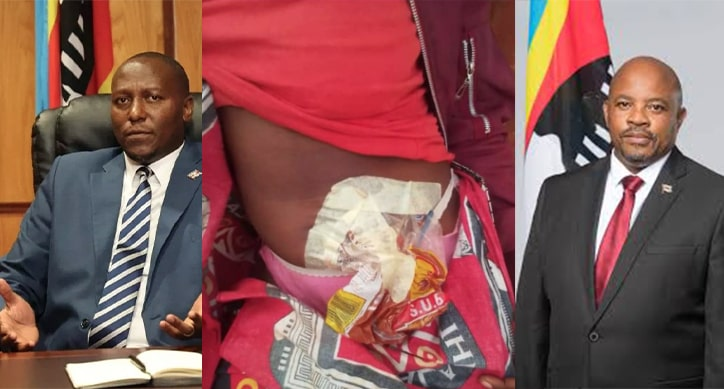NEW! <a href="/Inhlase1/">Inhlase</a> reveals that eSwatini’s ostomates face a silent but ruinous crisis: a nationwide shortage of colostomy, ileostomy &amp; urostomy bags that forces patients to reuse worn-out pouches, improvise with plastic bread bags, or go without altogether. twp.ai/4isN3O