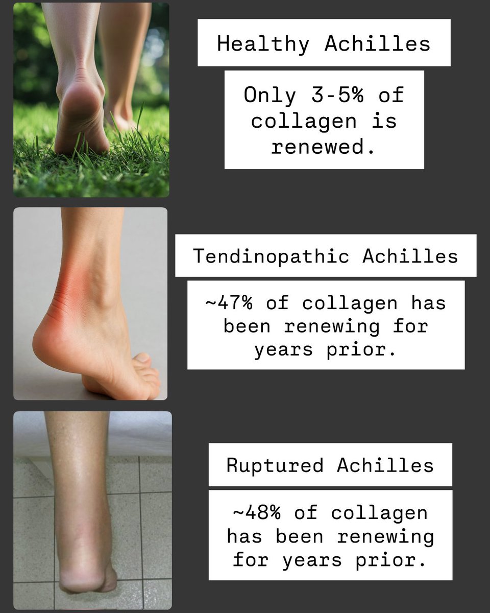 Healthy Achilles: pubmed.ncbi.nlm.nih.gov/23401563/

Tendinopathic Achilles: pubmed.ncbi.nlm.nih.gov/29570396/

Ruptured Achilles: pubmed.ncbi.nlm.nih.gov/37313851/