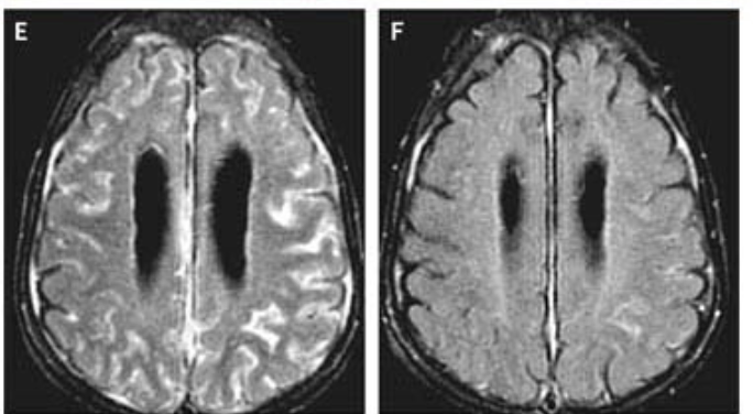 Jordan Gauthier tweet media