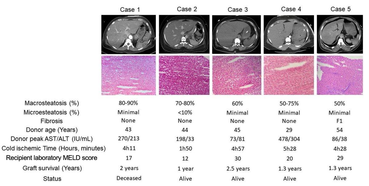 Raphael Meier MD-PhD tweet media