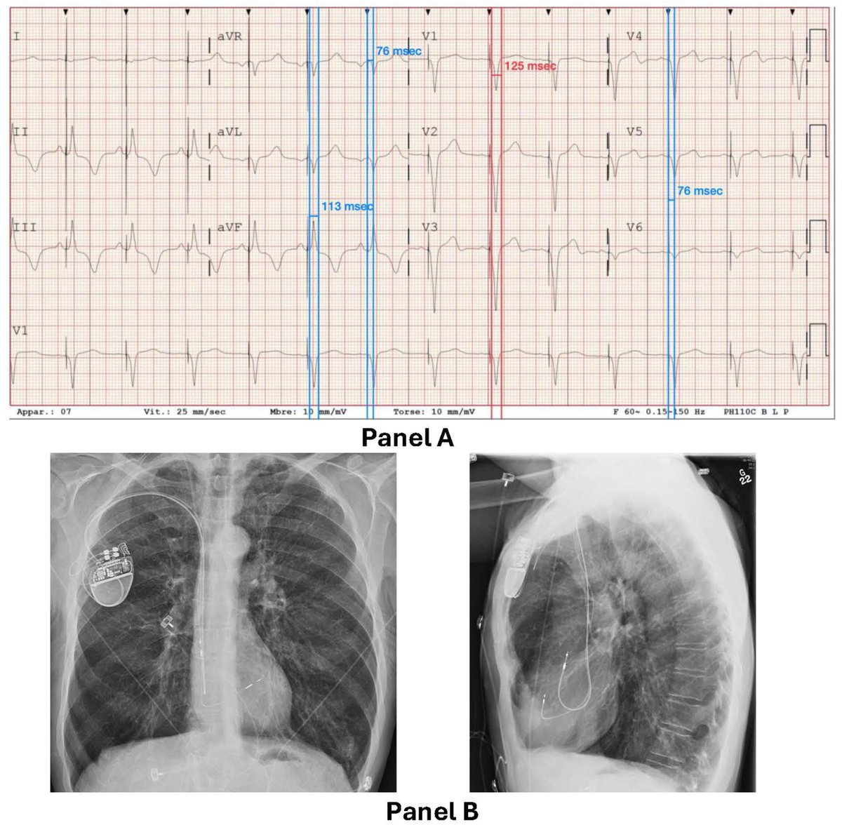 Heart Rhythm Case Reports tweet media