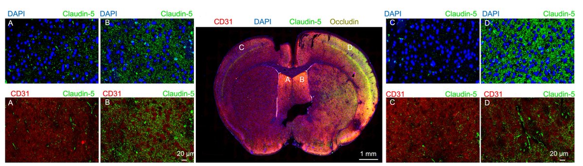 endothelialnews's tweet photo. Researchers found that isoflurane facilitates hemispheric lateralization in BBB permeability, leading to different responses between the left and right hemispheres. 🧠

📖 https://t.co/Nyt7PjF87b https://t.co/eyOZfLdKHw