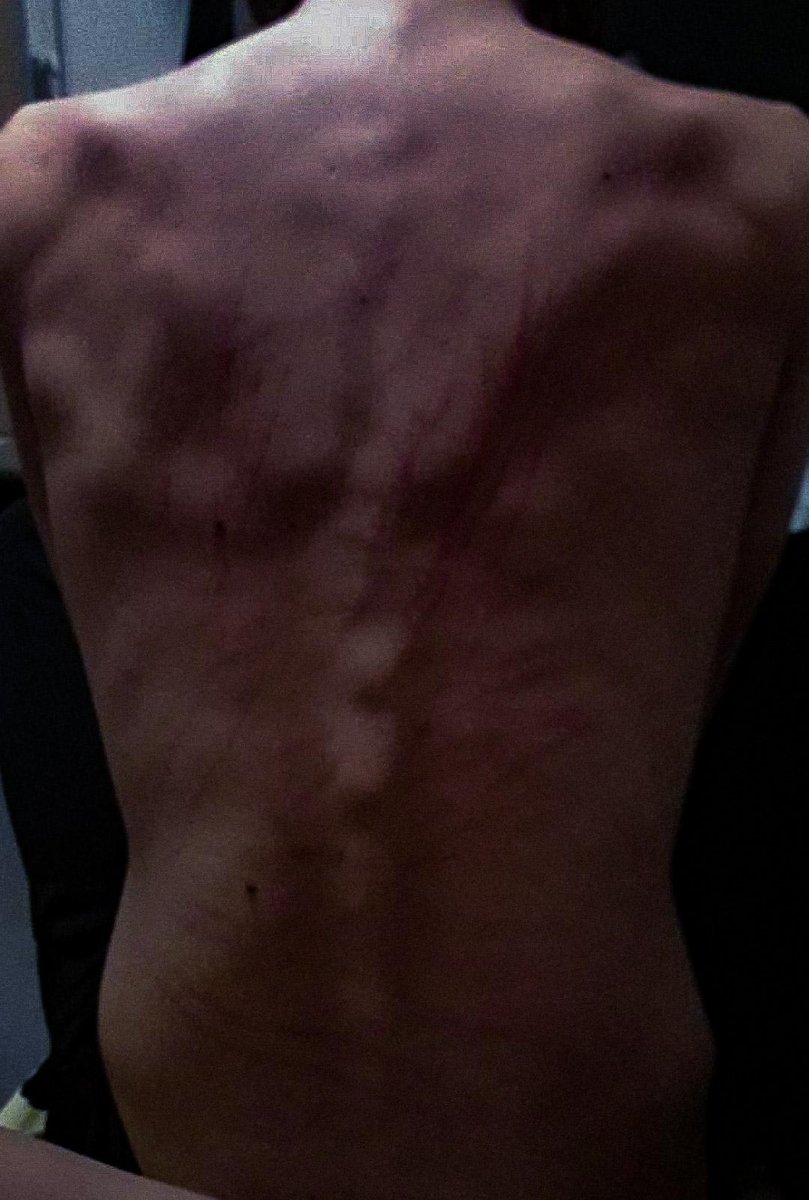 Anonymous_M4str's tweet photo. Miss my back looking like this https://t.co/auZf1A5ncI