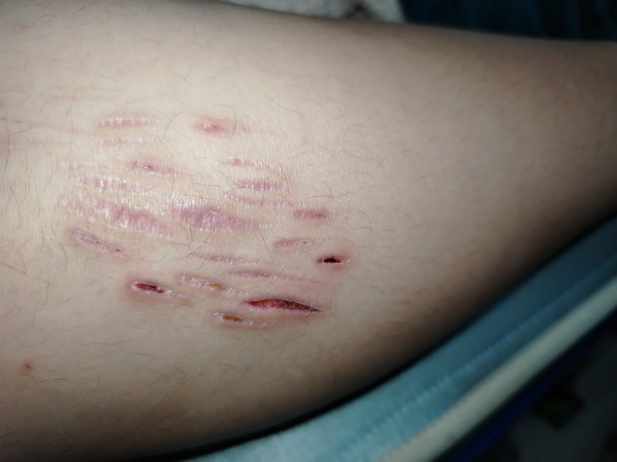_Al_29's tweet photo. I miss cutting myself https://t.co/hS62IzwOX4