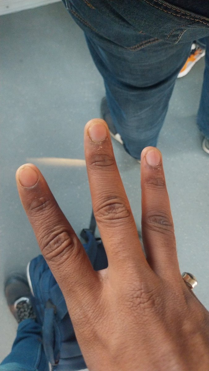 Ayush 🐳 $BLUAI tweet media