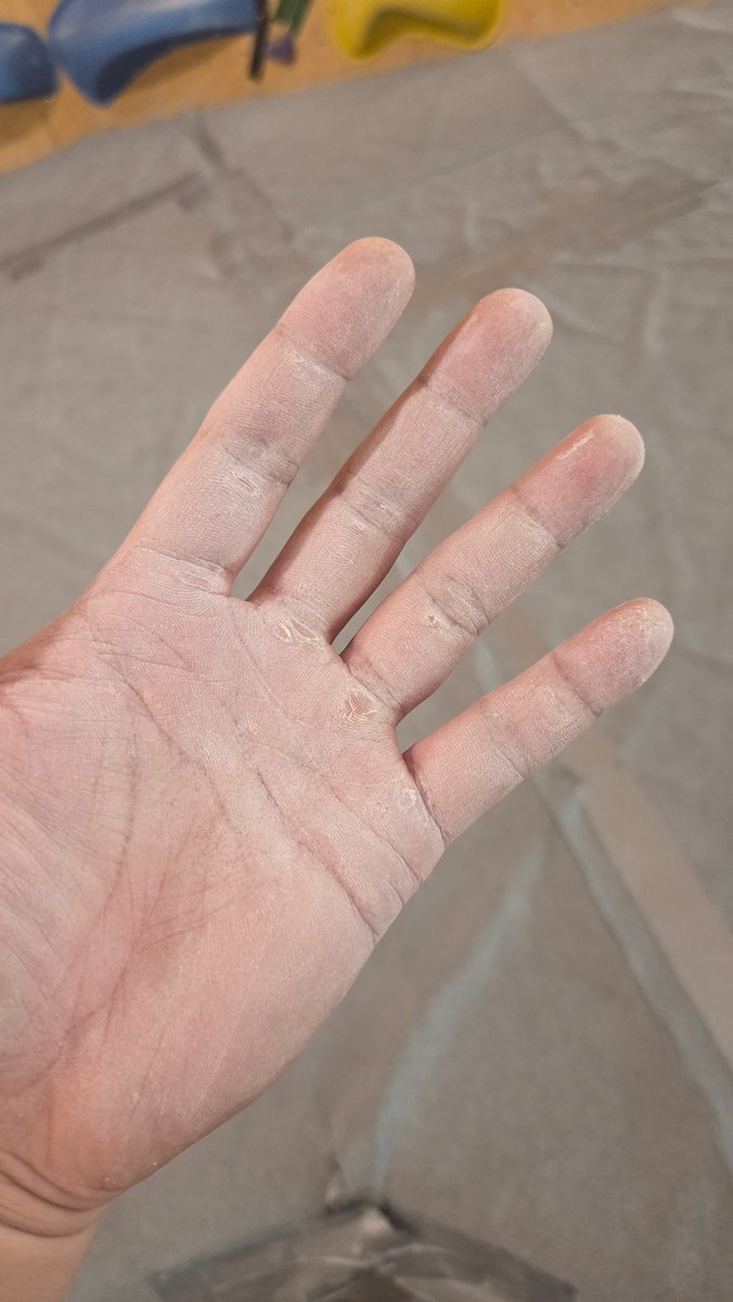 클라이밍하니까 손 꼬라지