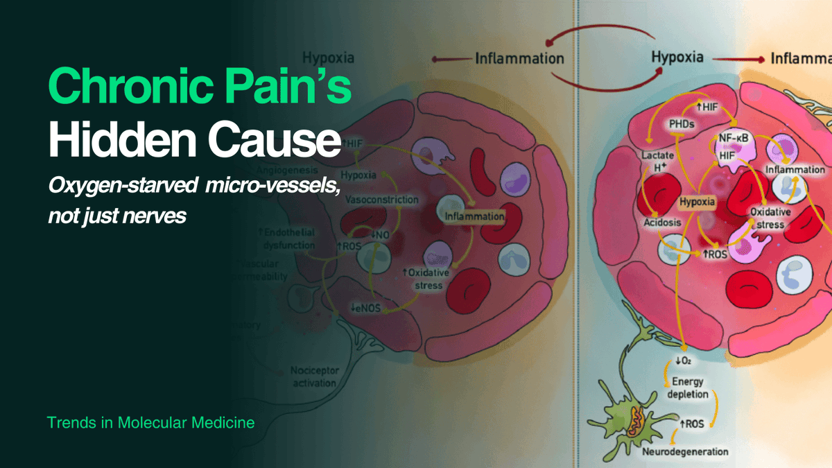 DebsChaliha's tweet photo. What if chronic pain isn’t just inflammation or nerves — but oxygen shortage from stressed microvessels? This could mean new ways forward for detection/treatment! Read here: https://t.co/90HptZYGti #ChronicPain #PainResearch #MedicalResearch #NewIdeas #TrendsInMolecularMedicine https://t.co/1r9L1cc7zM
