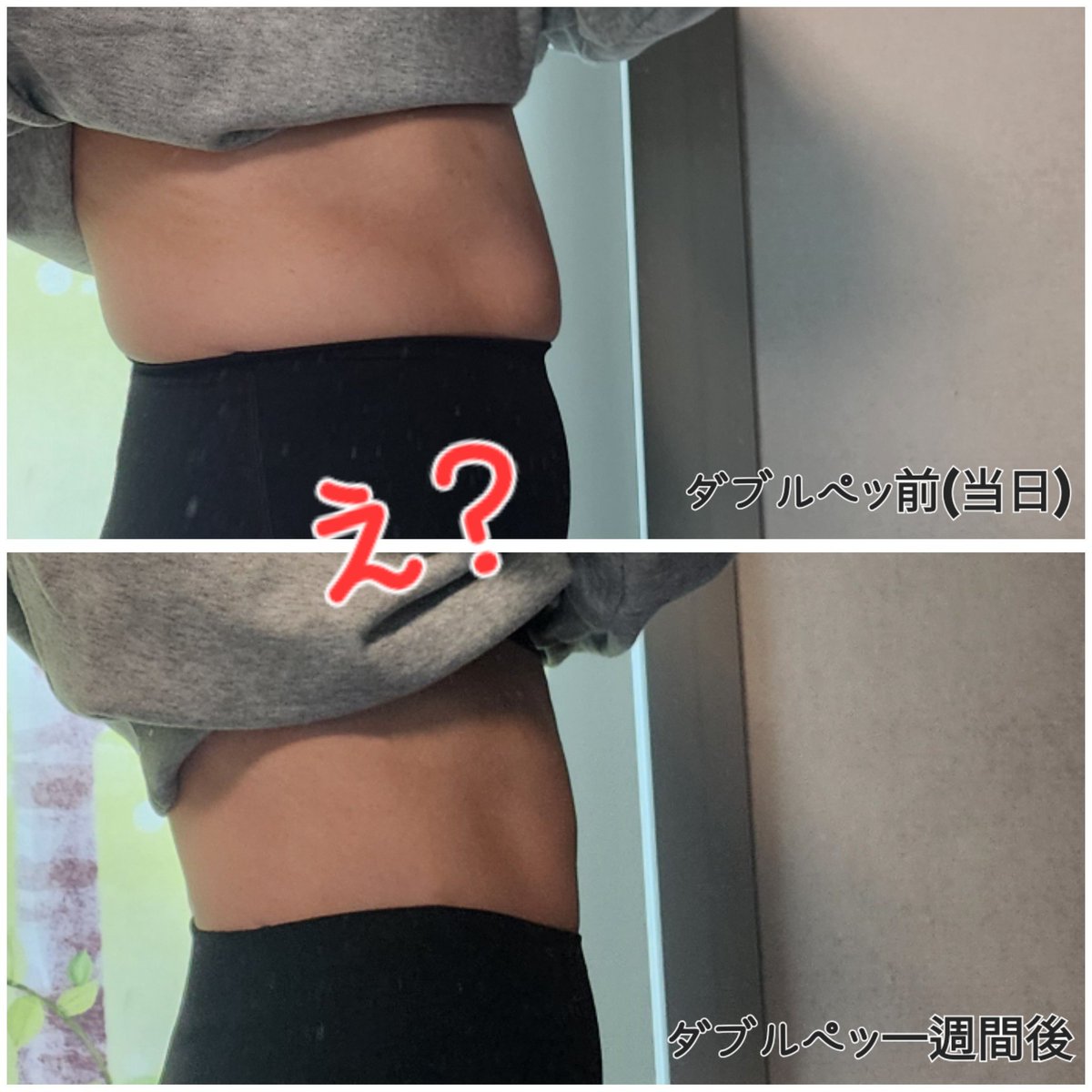 公式】プランエスクリニック（PLAN;SCLINIC） (@plansjp) / Posts / X