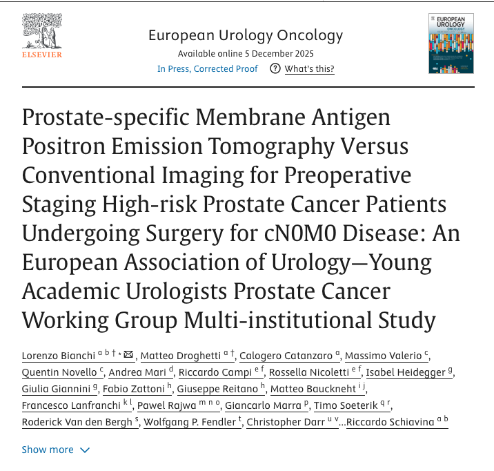 APCCC_Lugano's tweet photo. Prostate-specific Membrane Antigen Positron Emission Tomography Versus Conventional Imaging for Preoperative Staging High-risk Prostate Cancer Patients Undergoing Surgery for cN0M0 Disease: An European Association of Urology—Young Academic Urologists Prostate Cancer Working Group Multi-institutional Study

https://t.co/Oszxt1rdOJ

This multicenter retrospective study assessed whether modern PSMA-PET staging improves short-term outcomes compared with conventional imaging in 1475 high-risk prostate cancer patients treated with radical prostatectomy and extended lymph node dissection. After careful matching of baseline characteristics, patients staged with PSMA-PET had markedly lower rates of PSA persistence and significantly better 3-year biochemical recurrence–free survival than those staged conventionally. PSMA-PET was an independent predictor of reduced recurrence risk, and its use appeared to diminish outcome differences between patients with varying numbers of high-risk features. 

Despite limitations inherent to retrospective design, the findings suggest that the superior accuracy of PSMA-PET staging may translate into improved early oncologic outcomes after surgery. #ProstateCancer

@Lorenzo26232839
@drMDrog
@andreamari08
@Ric_Campi
@NICOLETTIRosse1
@Fabio_Zattoni
@MBauckneht
@flanfranchiMD
@dr_rajwa
@GMarra_MD
@roodvdb
@JGomezRivas
@ClaudiaKesch
@GGandaglia
@FrancescoCeci13
@andrea_farolfi
@paolo_gontero
@stefanofanti4
@LoreMasieri
@minerviniandre
@Albert0Briganti
@F_Montorsi
@riccardoschiav6 

@OncoAlert 🚨
@silkegillessen 
@AOmlin 
@weoncologists