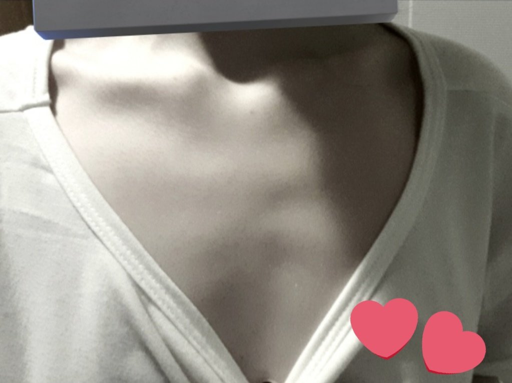 some recent bcs .ᐟ.ᐟ #edtwt i feel like i look sm bigger than 96lbs,, say hi 2 my plushie in the back his names popcorn ^+^