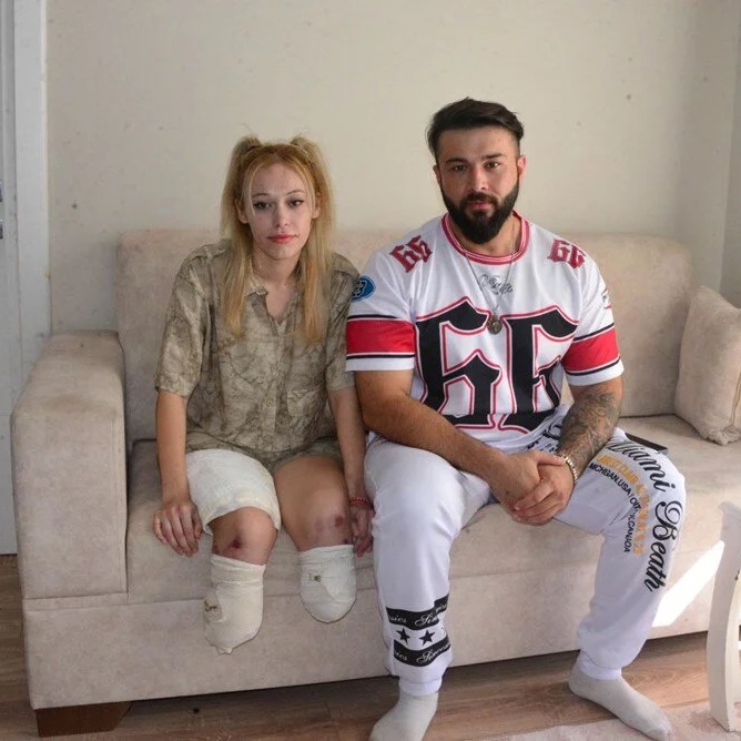 Gaziantep'te eşiyle evlilik yıl dönümünü kutlamaya giden İrem Karatutlu'nun bacaklarını kaybetmesine neden olan TIR sürücüsünün 15 yıla kadar hapsi istendi.

İrem Karatutlu: "İnsan canı bu kadar ucuz değil. TIR şoförü yaklaşık 3-4 yıl sonra cezaevinden çıkacak ve hayatına devam