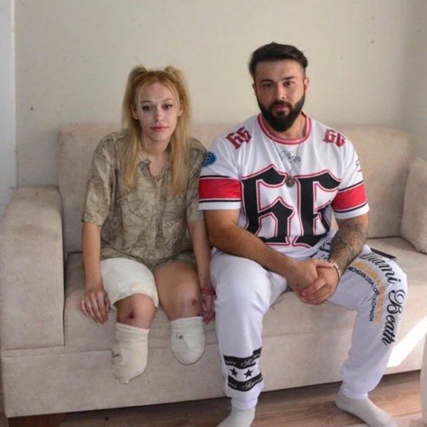 İrem Karatutlu'nun bacaklarını kaybetmesine neden olan TIR sürücüsünün 15 yıla kadar hapsi istendi.

İrem Karatutlu: “3-4 yıl sonra cezaevinden çıkacak ve hayatına devam edecek ama ben ömür boyu bu şekilde kalacağım.

Benim iki bacağımın canı bu kadar ucuz olmamalı.”