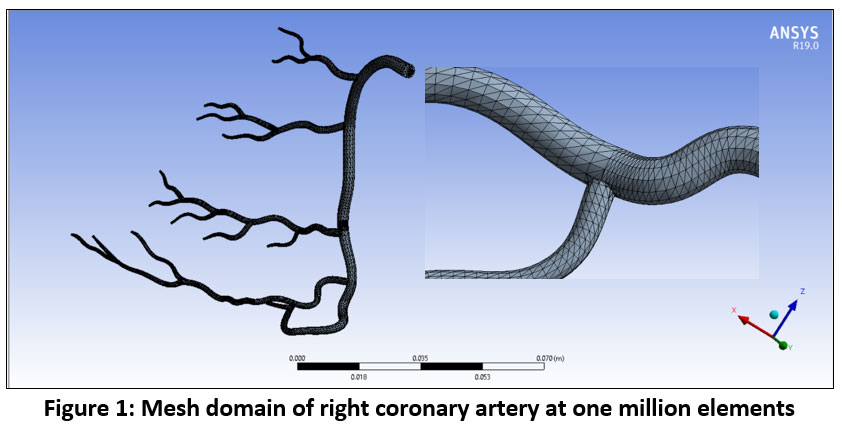 biomed_pharma's tweet image. Numerical CFD Simulation of Pulsatile Blood Flow in Stenosed Coronary Arteries under Different Physical Conditions: Walking, Running, and Standing

Read the Article here: bit.ly/4iIkWss

#ArterialWallDeformation #ComputationalFluidDynamics #CoronaryArteryDisease