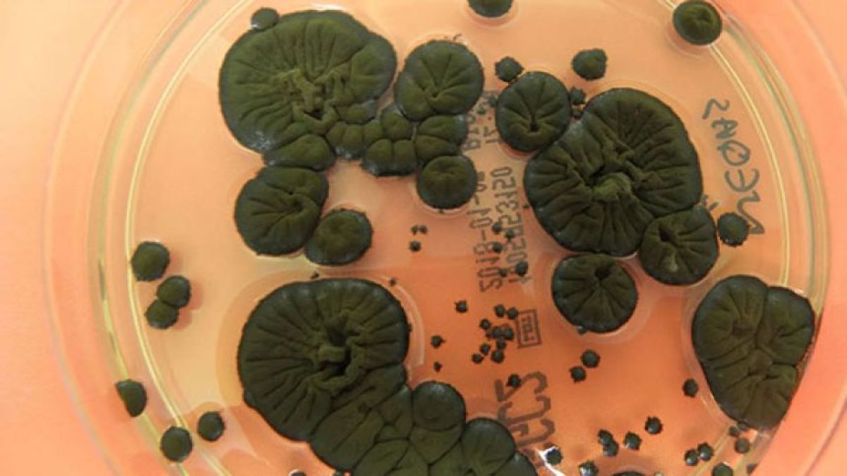 karapaia's tweet photo. チェルノブイリで発見された放射線を食べる真菌、宇宙利用への実験
https://t.co/0zvRlL83Sc

チェルノブイリの立ち入り禁止区域で発見された「黒い真菌（カビ）」は、放射線を食べてエネルギーに変える能力を持っており… https://t.co/Tpd55JPjnL