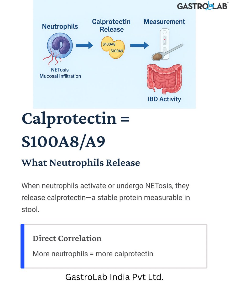 ajitkolatkar's tweet photo. Calprotectin 🟰What Neutrophils Release

Calprotectin (S100A8/A9) is released when neutrophils activate or undergo NETosis.
More neutrophils = higher fecal calprotectin = more active intestinal inflammation.
#Calprotectin #GITwitter #MedTwitter (4/8) https://t.co/wFbg2ScI2i