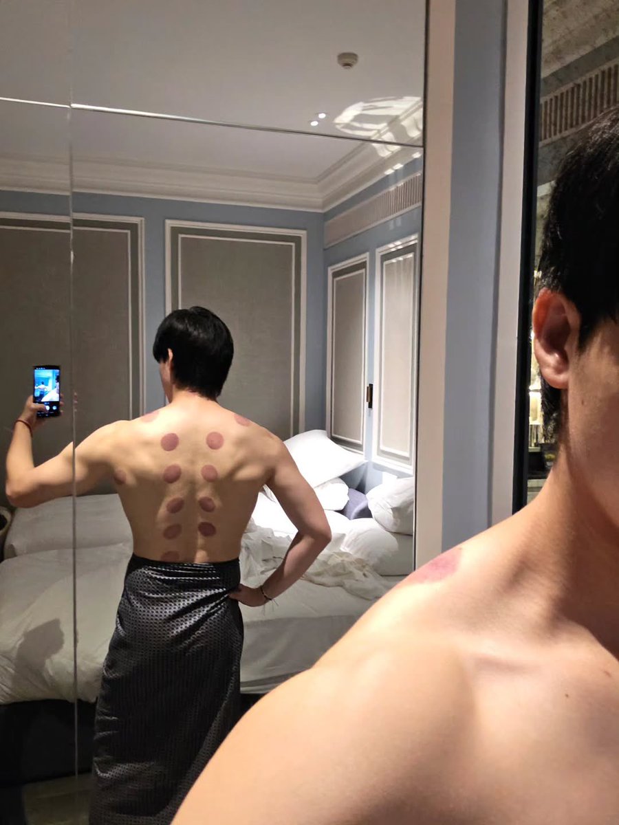 isknnu's tweet photo. โอ้โหสกาย ครอบแก้ว ฝังเข็ม โยคะ มาร์กหน้า กี่กิจกรรม work life balance ดีเยี่ยม สุดยอดครับ

#skywongravee https://t.co/LifrxJbVhj