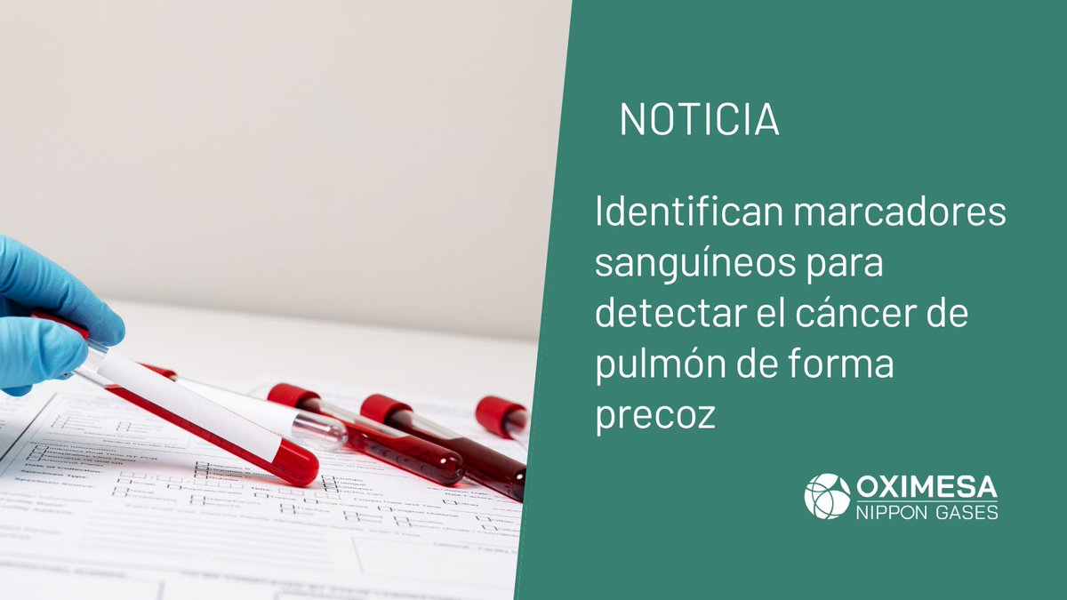 🫁 Científicos del Cancer Center de la <a href="/CIMA_unav/">Cima Universidad de Navarra</a> coordinan un estudio internacional para identificar marcadores en sangre que permitan un diagnóstico precoz

f.mtr.cool/vhikoizjuz vía <a href="/infosalus/">Ilaria Pucci</a>
