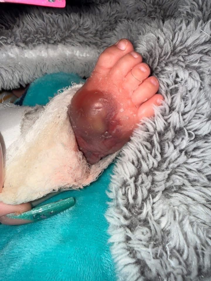 MillyMendezpr's tweet image. Dpto de Salud va a investigar la denuncia que hizo una madre alegando negligencia médica. Su bebé de 5 meses entró por una bronquiolitis y se encontró con este escenario.