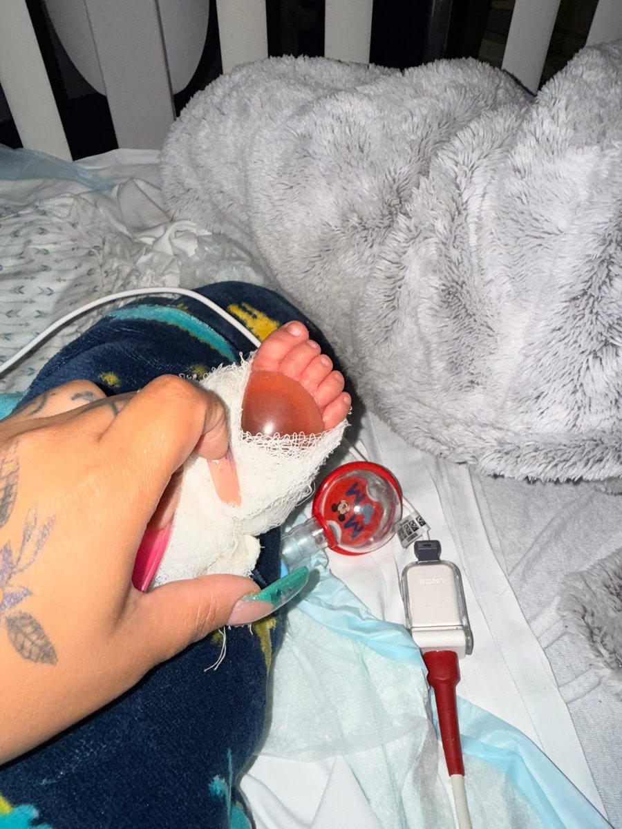 MillyMendezpr's tweet image. Dpto de Salud va a investigar la denuncia que hizo una madre alegando negligencia médica. Su bebé de 5 meses entró por una bronquiolitis y se encontró con este escenario.