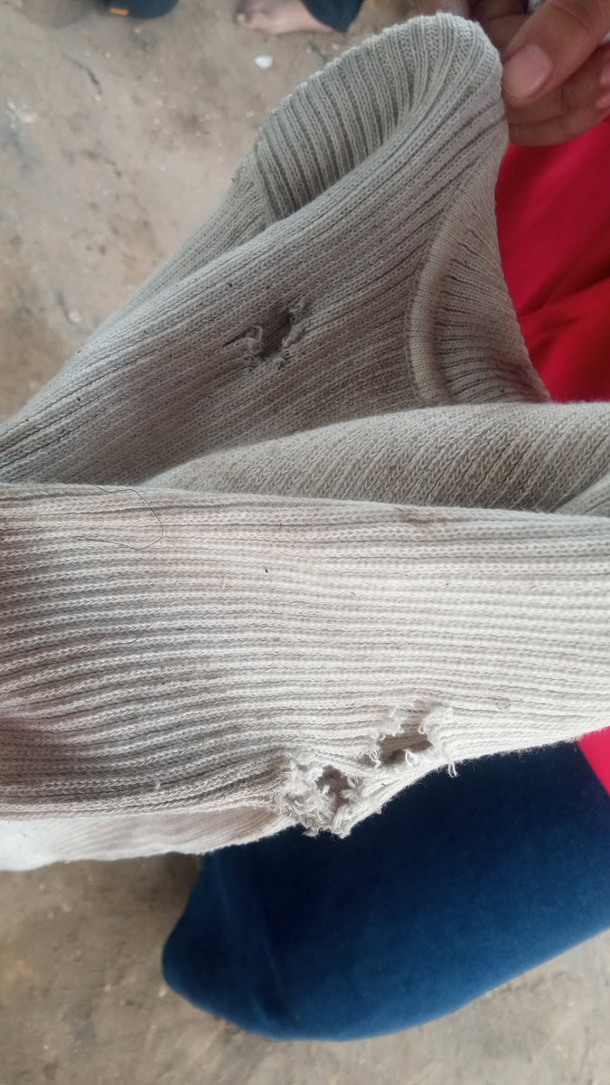 Ruba58849515's tweet photo. Türk kardeşlerime bir çağrım var: Hayatımız her geçen gün daha da zorlaşıyor, özellikle de şu günlerde yaşadığımız aşırı soğukla birlikte. Tüm eşyalarımızı, hatta kıyafetlerimizi bile kaybettik. Kış için sıcak giysilerimiz yok. Lütfen bana yardım edin.
https://t.co/faToPLOT2i https://t.co/L653gb0LY2