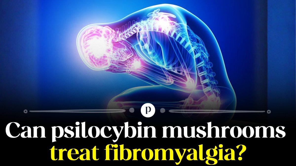 psychedelicscom's tweet image. Fibromyalgia patients tried psilocybin-assisted therapy, and the one-month shifts deserve your attention.

🧵 Here&apos;s how it went down...