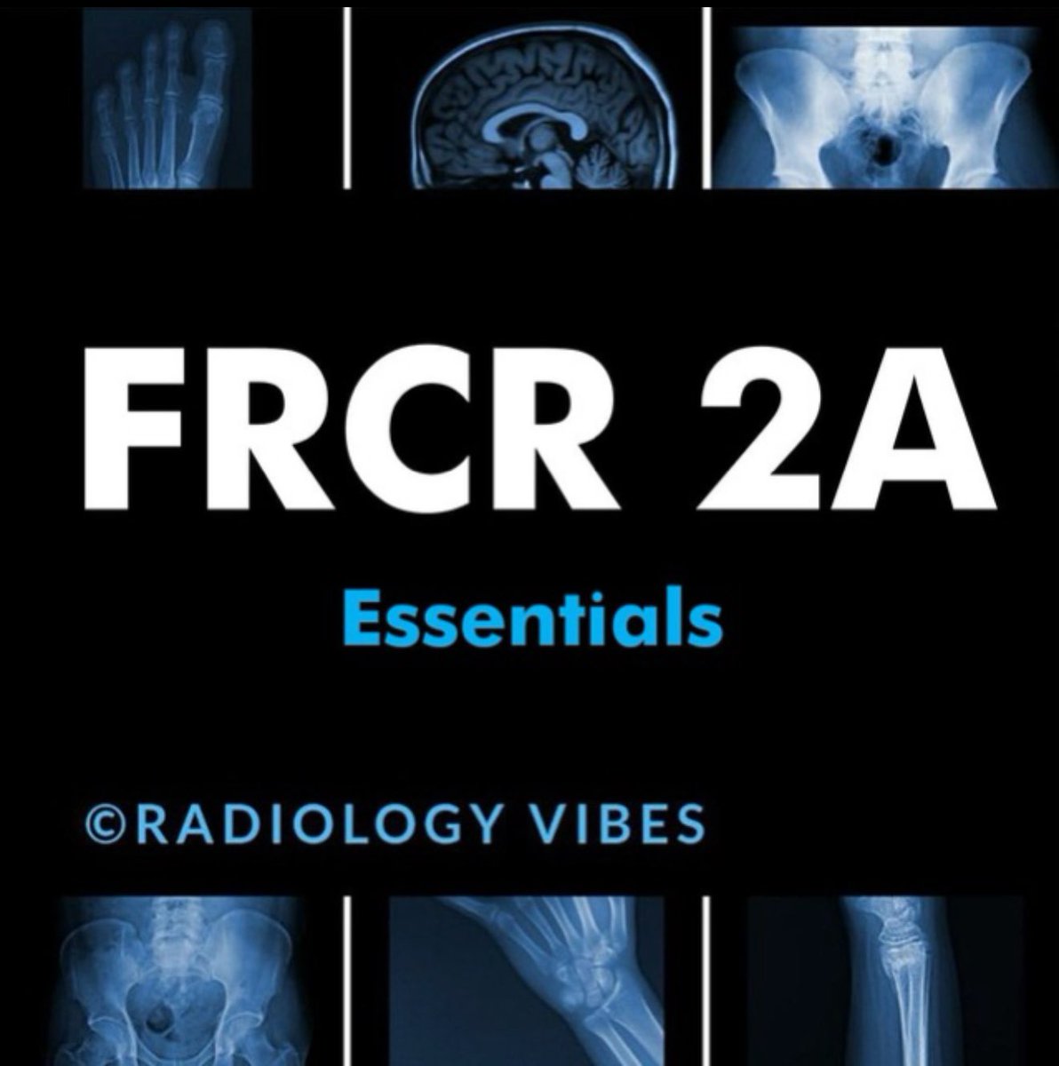 Calling all FRCR 2A aspirants! 📚🧠
We share daily high-yield FRCR 2A SBAs on our Telegram group to supercharge your prep! ⚡✅
👤 Real profiles only — ❌ anonymous profiles not allowed
👉 Join here: t.me/frcr_2a

#FRCR2A #RadiologyExams #MedTwitter #RadTwitter