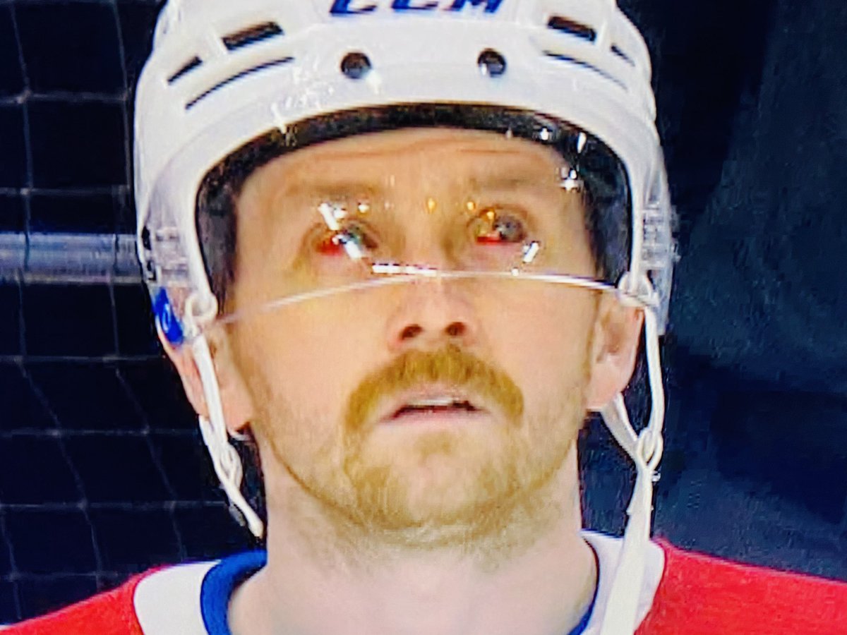 my god!!!
It's not for the lens!!!
It's the Jeff Petry rule

He got his finger stuck in the camera hole in a match... Since, the camera guy most close the hole as soon a player's getting close!

Picture = Petry eye after breaking his finger